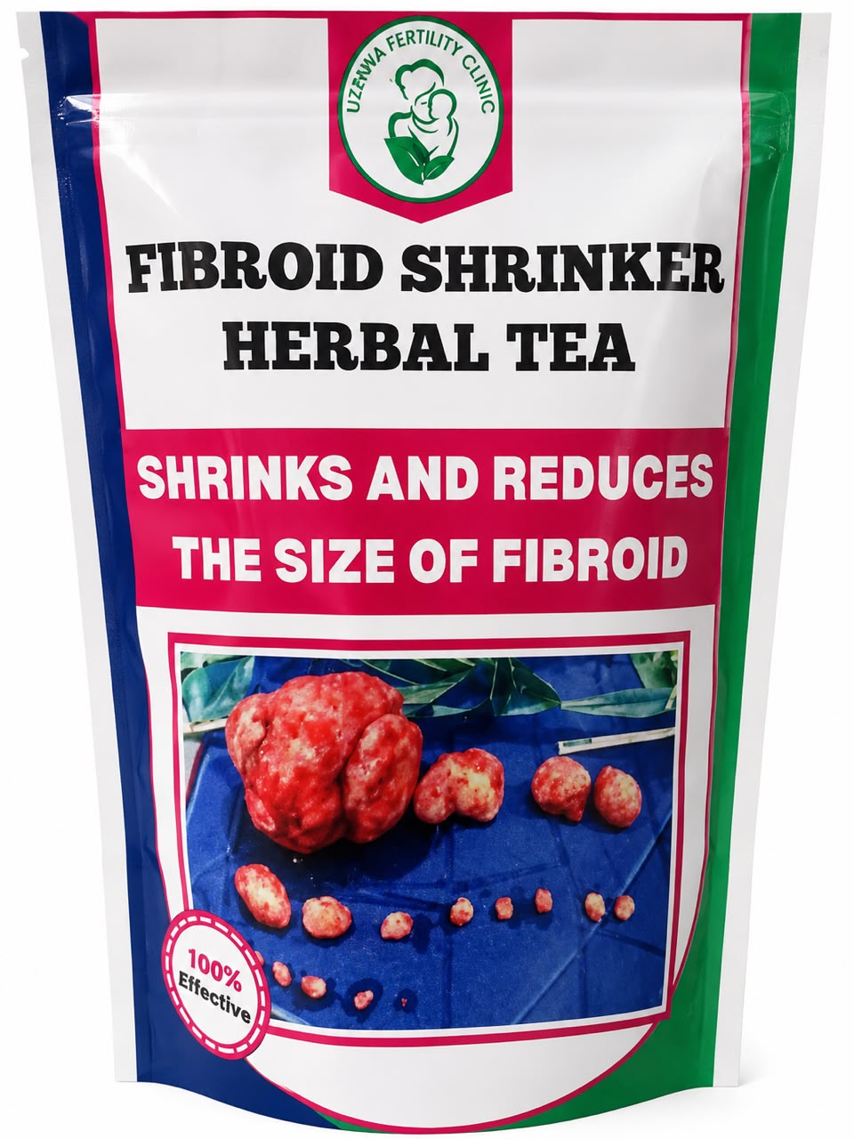 Fibroid Shrinker Tea: Your Natural Path to Relief